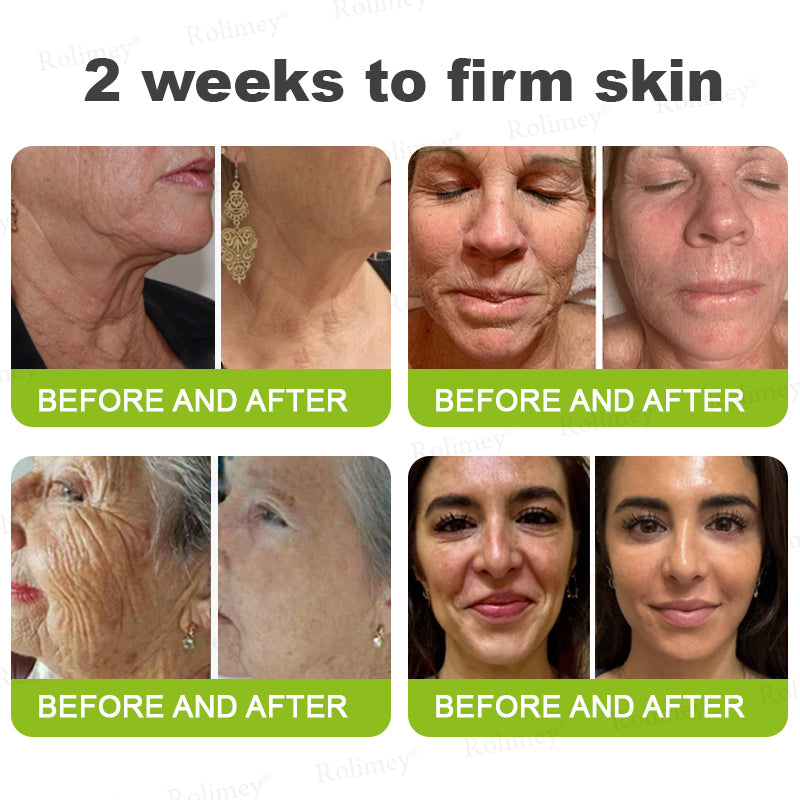 ✅Rolimey® Botox And Vita A Retinol Shot Wrinkle-Lift Tightening cream