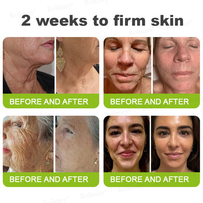 ✅Rolimey® Botox And Vita A Retinol Shot Wrinkle-Lift Tightening cream