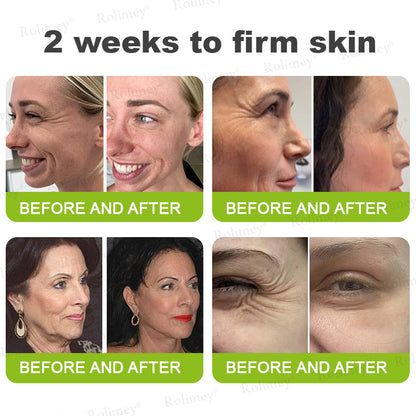 ✅Rolimey® Botox And Vita A Retinol Shot Wrinkle-Lift Tightening cream