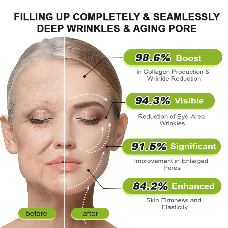 ✅Rolimey® Botox And Vita A Retinol Shot Wrinkle-Lift Tightening cream