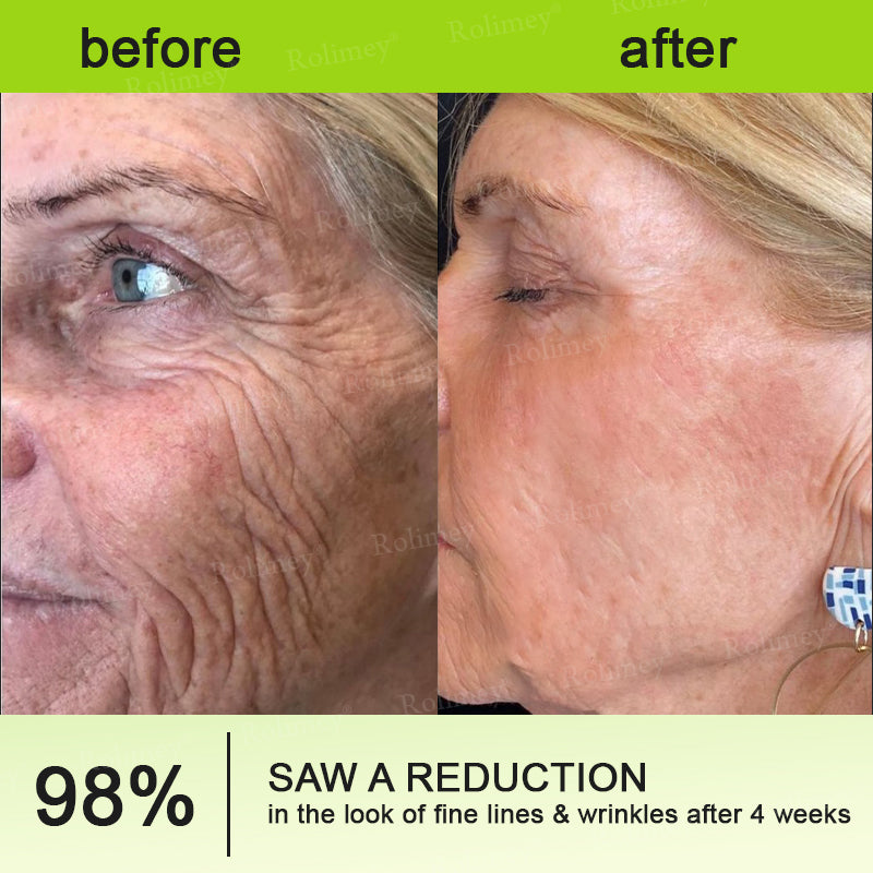 ✅Rolimey® Botox And Vita A Retinol Shot Wrinkle-Lift Tightening cream