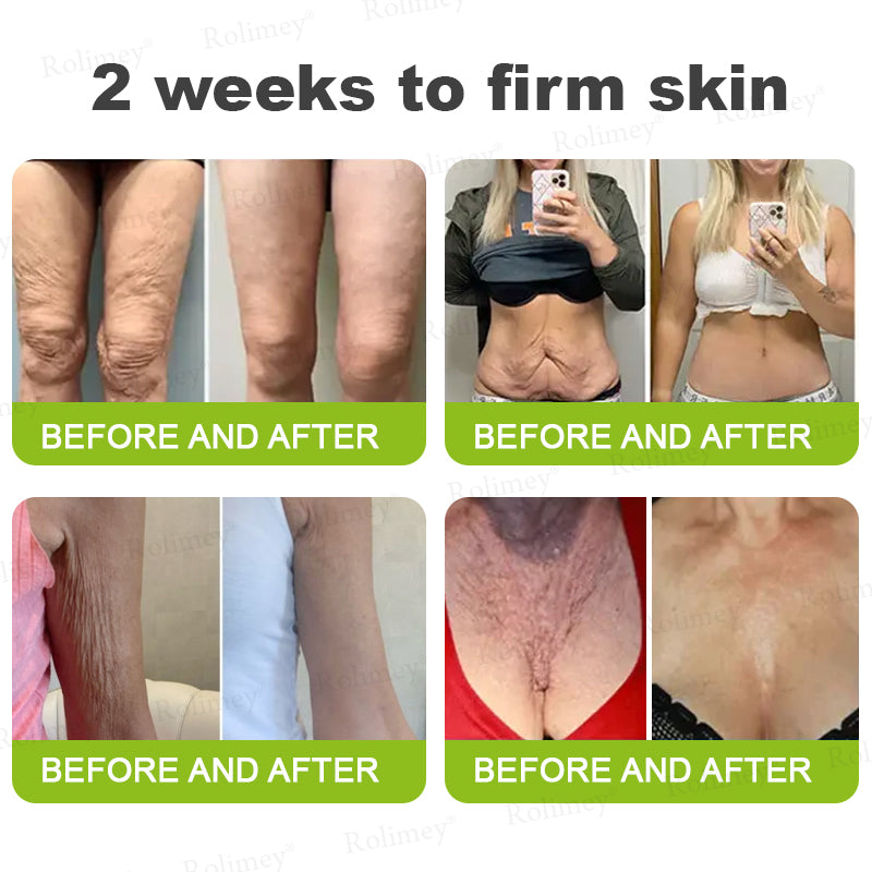 ✅Rolimey® Botox And Vita A Retinol Shot Wrinkle-Lift Tightening cream