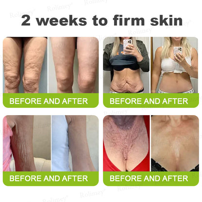 ✅Rolimey® Botox And Vita A Retinol Shot Wrinkle-Lift Tightening cream