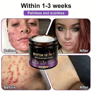 Made and Shipped from USA ✨Aihemy® Biotin 10-in-1 Skin Restoration Cream 🍀