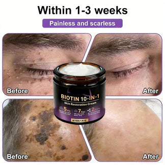 Made and Shipped from USA ✨Aihemy® Biotin 10-in-1 Skin Restoration Cream 🍀