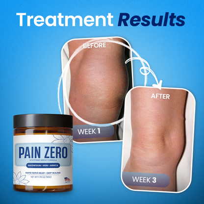 Aihemy® Pain Zero Magnesium Total Relief Cream