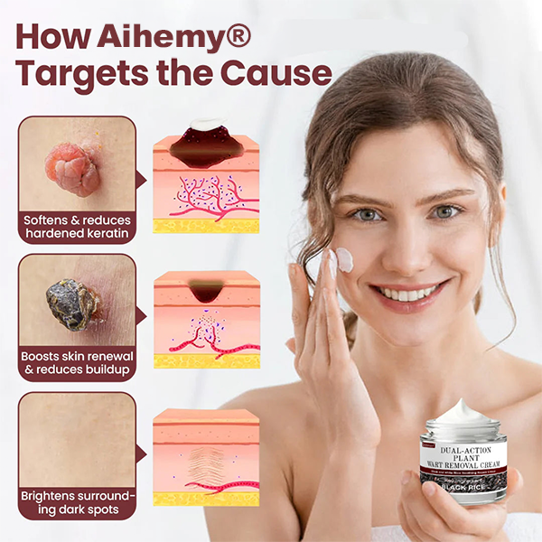 ✅Aihemy® Dual-Action Plant Wart Removal Cream（👨‍⚕️Skin Tags,Acne,Hyperpigmentation,Eczema,Psoriasis,Rosacea,Warts)